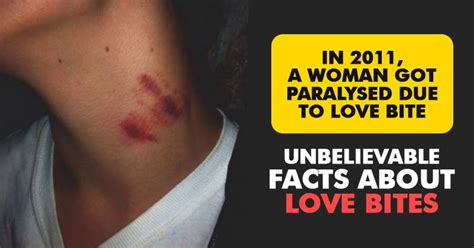 You Would Not Be Aware Of These Facts About Love Bites Read Only If