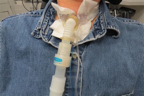 Tracheostomy Tracheostomy Tube Tracheostomy Care Images