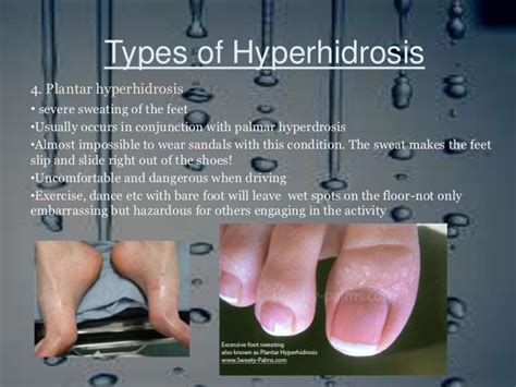 Pin By Conceal Shield On Hyperhidrosis Barefoot Exercise