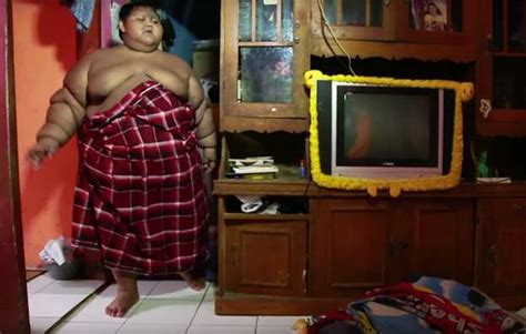 Niño De 10 Años Es El Más Gordo Del Mundo Pesa 191 Kilos