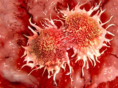 Cancer Cells Eat Themselves To Survive Life Threatening Damage