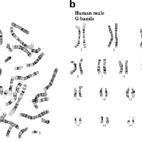 A G Banded Chromosomes Of A Male As Seen Under A Microscope And B Download Scientific