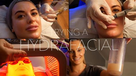 What Is A Hydrafacial Review Results Before And After Eleise Youtube