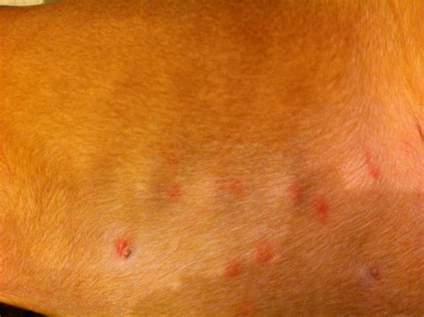 Hives Boxer Forum Boxer Breed Dog Forums