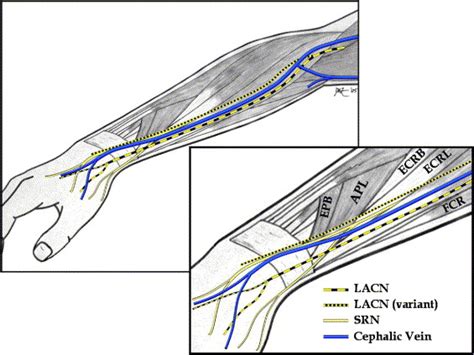 Anatomy Of The Lateral Antebrachial Cutaneous And Superficial Radial