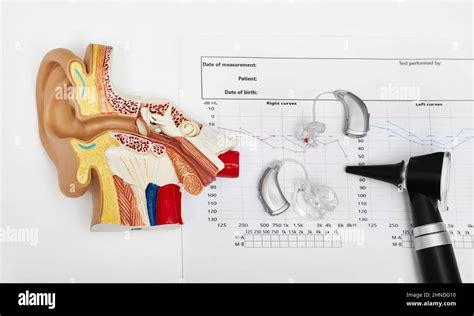 Hearing Test Concept Result Of Hearing Exam Audiogram Hearing Aids