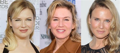 Renee Zellweger Plastic Surgery Before And After Pictures 2021