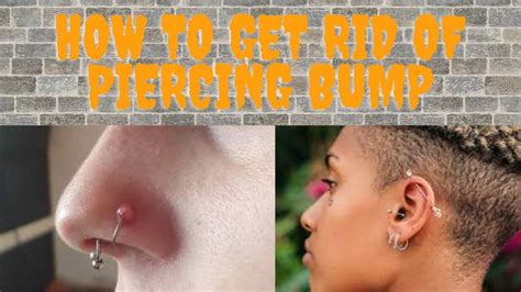 How To Get Rid Of Piercing Bump Best Ways 2k22