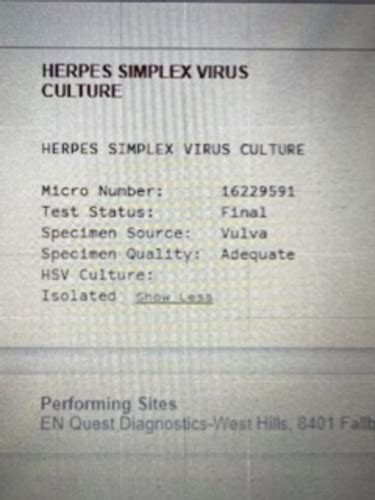 Culture Results Genital Herpes Simplex Forums Patient