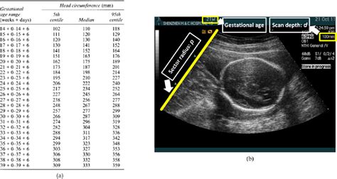 Ultrasound Fetal Measurement Chart