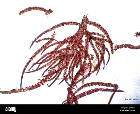 Red Algae Under Microscopic View Rhodophyta Stock Photo Alamy