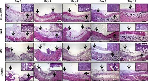 Histological Features Of Wound Healing In Mice With Decreased Or