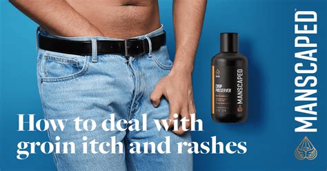 How To Deal With Groin Itch And Rashes Manscaped™ Blog