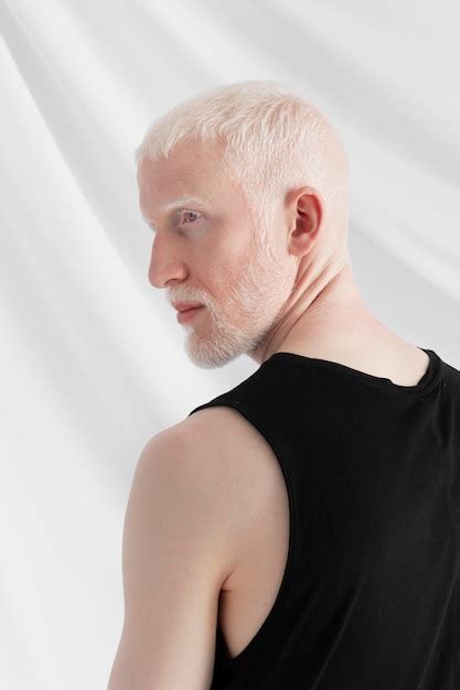 Free Photo Handsome Albino Man Posing