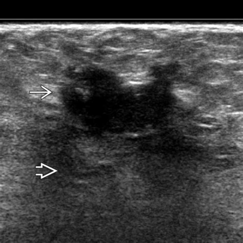 Fat Injury Radiology Key