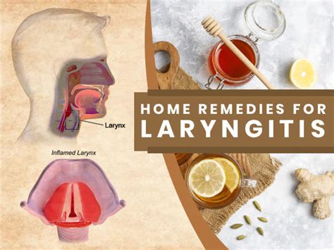 10 Simple Home Remedies For Laryngitis Hoarse Voice Number Six Is