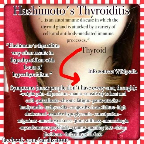 Hashimotos Thyroiditis Symptoms Share Hashimotos Thyroiditis