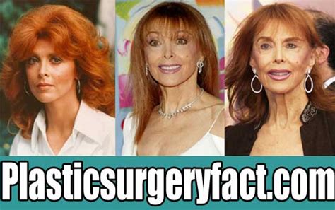 Tina Louise Plastic Surgery Before And After Plastic Surgery Facts
