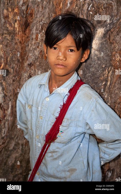 Myanmar Burma Young Burmese Boy In Village Near Bagan He Has Traces