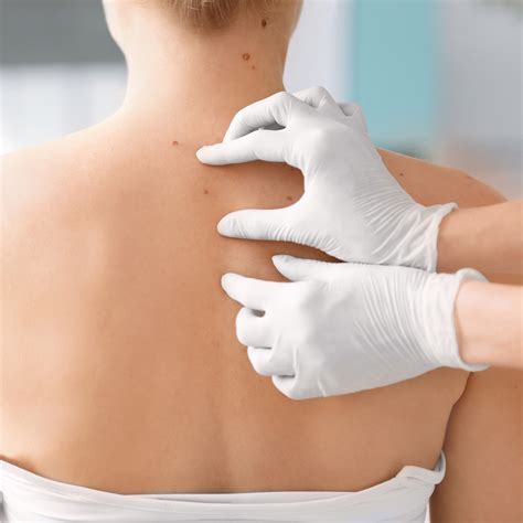 Health And Skin Cancer Checks Sanctuary Wellness And Medical Centre