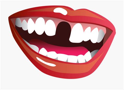 Dentist Missing Teeth Funny Clipart - Smile With Missing Tooth ...