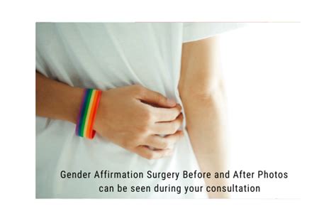 Gender Affirmation Surgery Sydney Dr Hunt