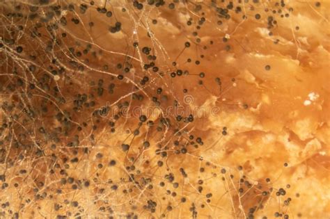 Healthprep.com has been visited by 1m+ users in the past month Rhizopus bread mold under the microscope. Rhizopus bread ...