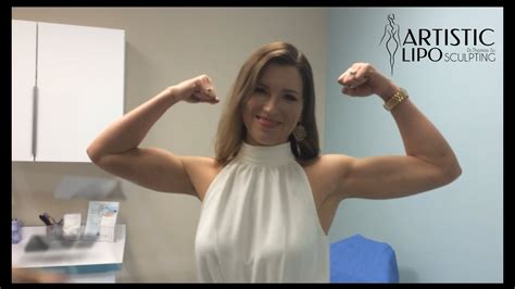 Arm Lift Liposuction Tampa Sarasota Orlando Celebrity
