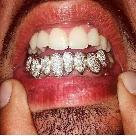 Permanent Diamond Teeth The Pros And Cons Coronet Diamonds