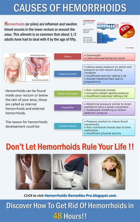 Hemorrhoids Are A Bothersome Trouble That Can Be Prevented Below Are