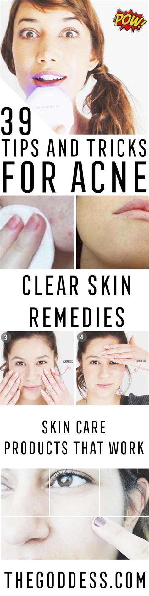 39 Acne Tips And Tricks Cover Up Pimples Clear Skin Tips Makeup Tips