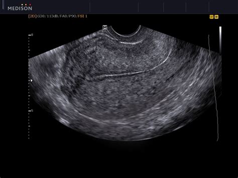 Blatt, m.d., gynecologist and chief. MEDISON.RU - Uterus, TVE / R7 (558)