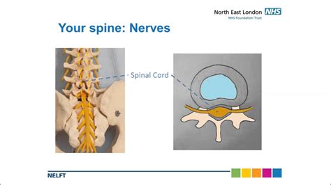 Basic Lumbar Spine Anatomy Youtube