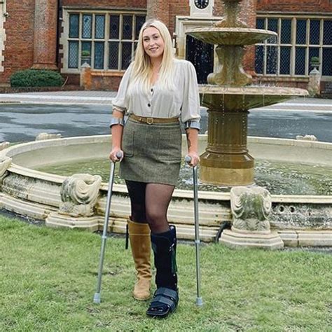 Still Needing A Boot And Crutches Two Years After Her Dui Accident