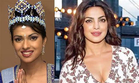 Bollywood Celebrities before and after plastic surgery ...
