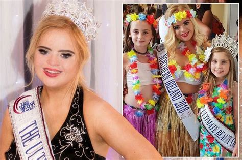 Teen Becomes First Model With Downs Syndrome To Win Global Beauty