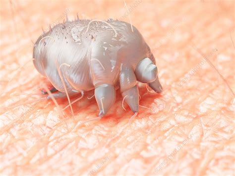 Illustration Of A Scabies Mite On Human Skin Stock Image F
