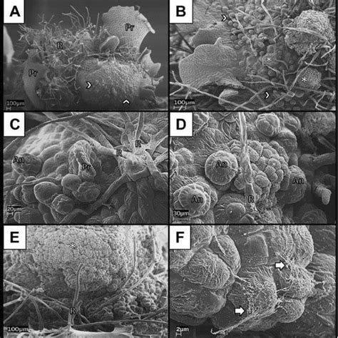 Transmission Electron Microscopy Of Two Cell Types Observed In Pteris