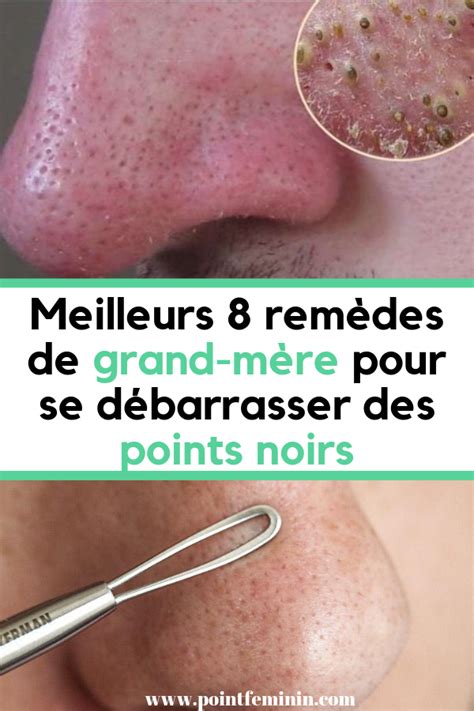 Pin On Beauté And Santé Au Quotidien