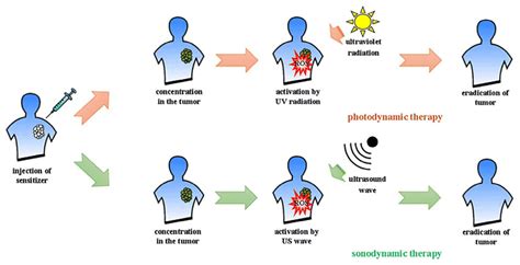 Schematic Overview Of Both Photodynamic Therapy Pdt And Sonodynamic