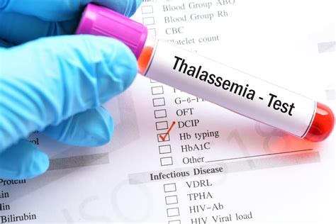 Hal Yang Perlu Anda Ketahui Tentang Jenis Jenis Thalassemia Honestdocs