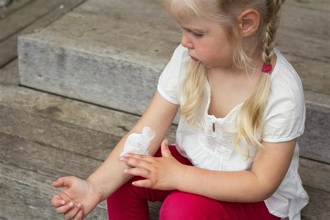 5 Ways To Treat And Prevent Poison Ivy Rash Inside Childrens Blog