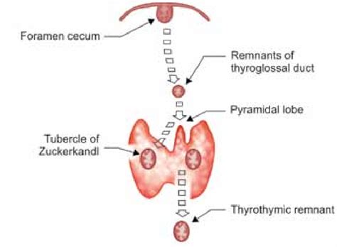 Please review the anatomic diagrams on the the thyroid gland consists of two lateral lobes joined by an isthmus. Development of embryological remnants of thyroid gland | Download Scientific Diagram