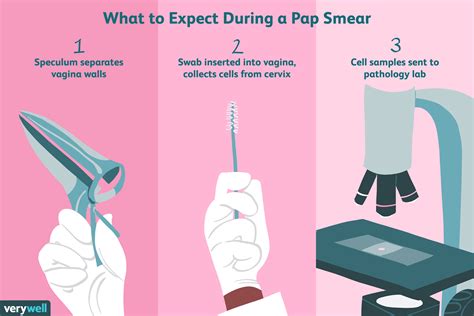 When To Do Pap Smear Test Prnso