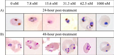 The Morphology Of P Falciparum Pulsed For 4 Hours With Art Download