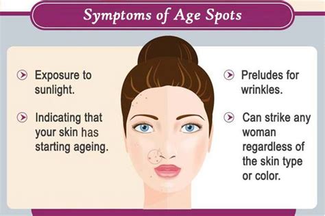 Age Spots On Face Guide To Reduce Age Spots And Symptoms