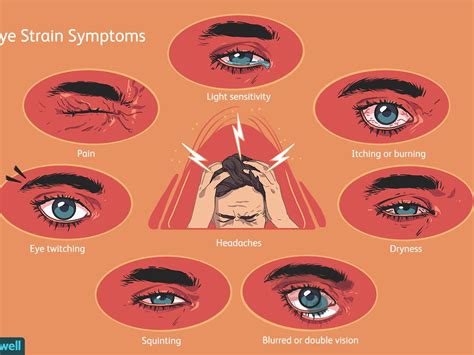 Eye Muscle Fatigue Symptoms Brownploaty
