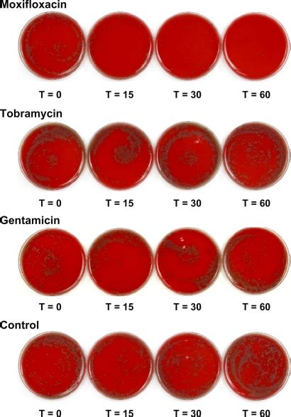 Photographs Of Streptococcus Pneumoniae Mcc 40211 Grown On Blood Agar