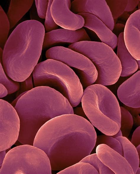 Human Red Blood Cells Photograph By Dennis Kunkel Microscopyscience