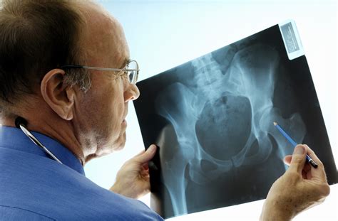Orthopedic Surgeons Things You Need To Know Penn Medicine